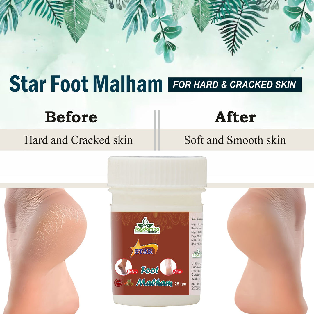 Star Foot Malham before and after results for cracked heels, dry feet and rough skin improvement.